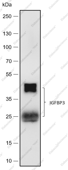 Recombinant IGFBP3 Monoclonal Antibody - 1