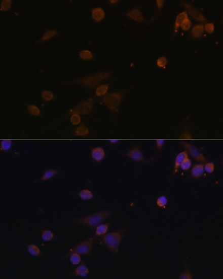 Immunofluorescence analysis of NIH/3T3 cells using NDUFA2 Polyclonal Antibody at dilution of 1:100. Blue: DAPI for nuclear staining.