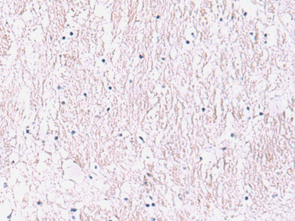 Immunohistochemistry of paraffin-embedded Human brain tissue  using SMPD2 Polyclonal Antibody at dilution of 1:90(?200)