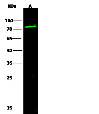 Recombinant SerpinG1/C1 inhibitor/C1IN Monoclonal Antibody - small - 2