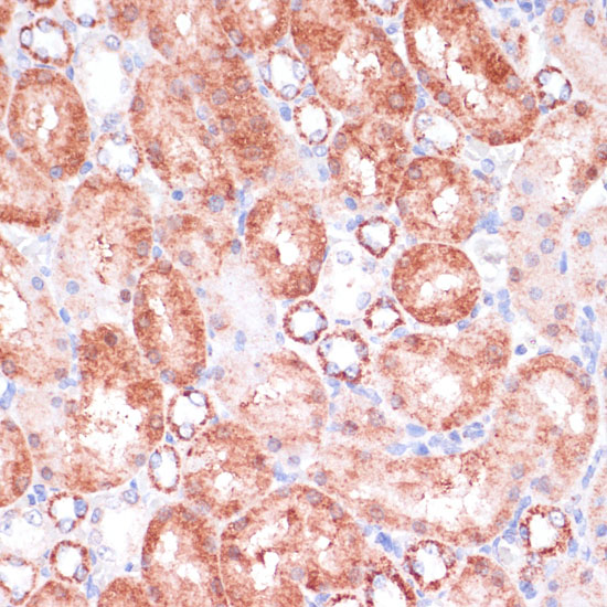 Immunohistochemistry of paraffin-embedded Rat kidney using VASP Polyclonal Antibody at dilution of  1:100 (40x lens).