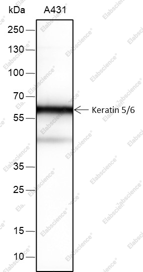 Recombinant Keratin 5/6 Monoclonal Antibody - 1