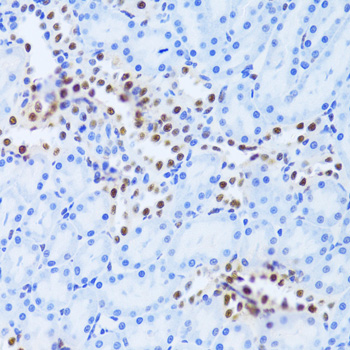 Immunohistochemistry of paraffin-embedded rat kidney using ANP32A Polyclonal Antibody at dilution of 1:100 (40x lens).Perform microwave antigen retrieval with 10 mM PBS buffer pH 7.2 before commencing with IHC staining protocol.