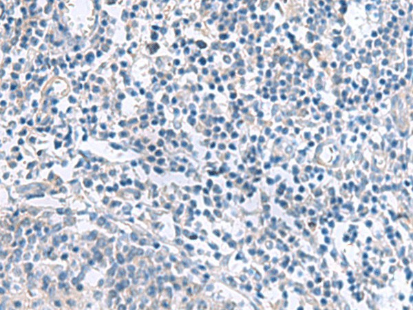 Immunohistochemistry of paraffin-embedded Human tonsil tissue  using MYL1 Polyclonal Antibody at dilution of 1:50(?200)