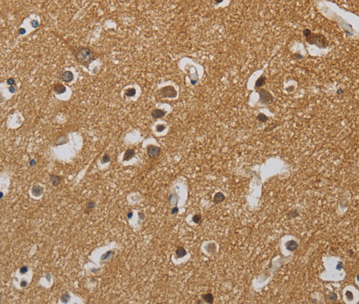 Immunohistochemistry of paraffin-embedded Human brain  tissue using KIF4A Polyclonal Antibody at dilution 1:40