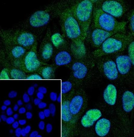 Recombinant CSNK2A1 Monoclonal Antibody - small - 5