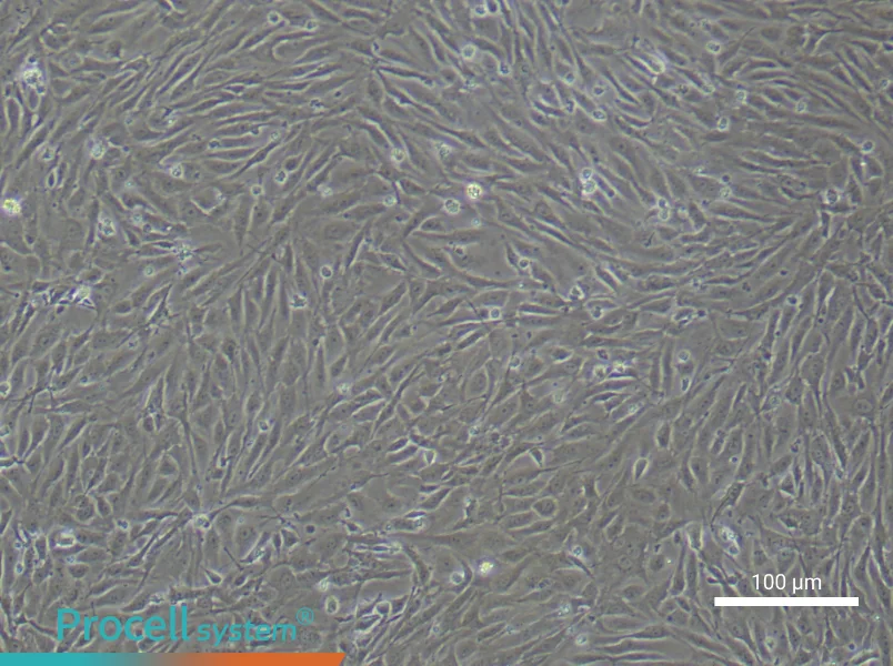 Human Lymphatic Endothelial Cell Complete Medium - 3