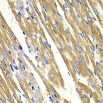 Immunohistochemistry of paraffin-embedded rat heart using Tyrosinase Polyclonal Antibody at dilution of 1:100 (40x lens).Perform microwave antigen retrieval with 10 mM PBS buffer pH 7.2 before commencing with IHC staining protocol.