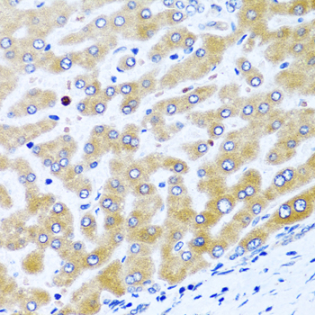 Immunohistochemistry of paraffin-embedded Human liver using CCL21 Polyclonal Antibody at dilution of  1:100 (40x lens).