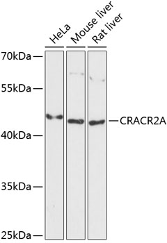 Western blot analysis of extracts of various cell lines using CRACR2A Polyclonal Antibody at 1:3000 dilution.