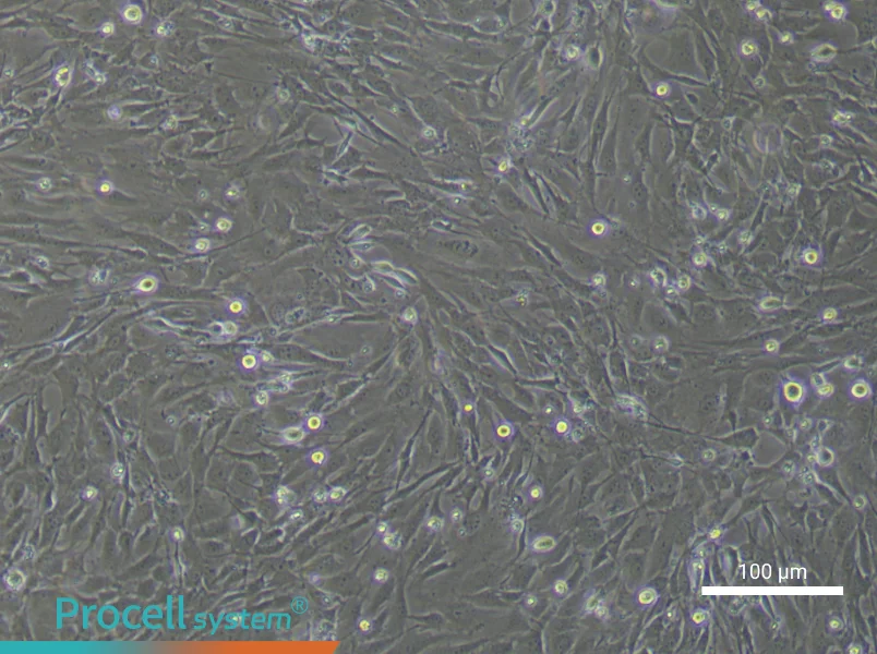 Mouse Periodontal Ligament FibroblastsMouse Periodontal Ligament Fibroblasts - 2