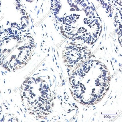 Recombinant NDUFS2 Monoclonal Antibody - 2