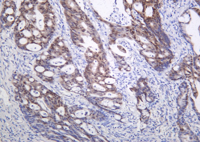 Recombinant CDX2 Monoclonal Antibody-searchlist-1