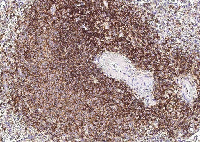 CD45/PTPRC Monoclonal Antibody - 2