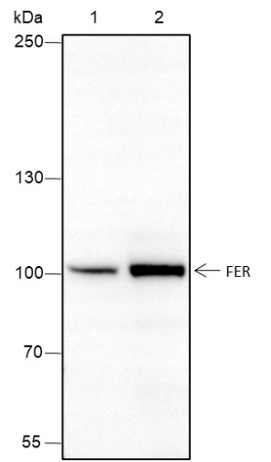 Recombinant FER Monoclonal Antibody-searchlist-1