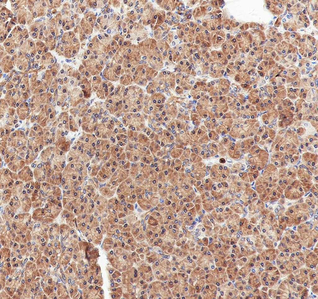 Recombinant PRDM4/PFM1 Monoclonal Antibody - 3