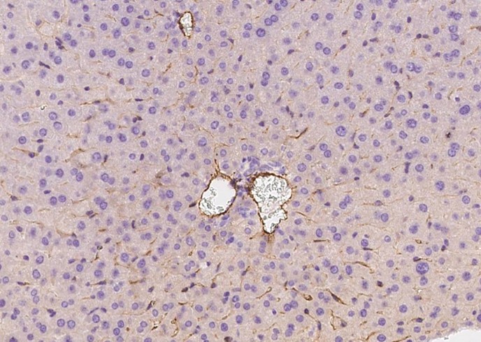 Recombinant CD146/MCAM Monoclonal Antibody-searchlist-1