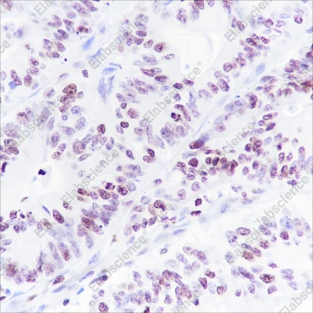 Recombinant Histone H1 (CT) Monoclonal Antibody - 3