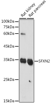 Western blot analysis of extracts of various cell lines using SFXN2 Polyclonal Antibody at 1:1000 dilution.