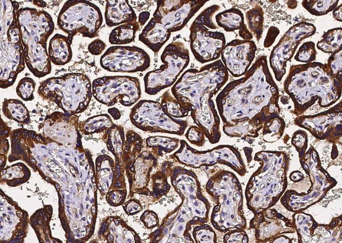 Recombinant TRAIL R4/CD264/TNFRSF10D Monoclonal Antibody-searchlist-1