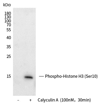 Recombinant Phospho-Histone H3 (Ser10) Monoclonal Antibody-searchlist-1