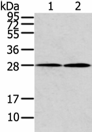 Western Blot analysis of Mouse heart and lung tissue using KCNMB1 Polyclonal Antibody at dilution of 1/500