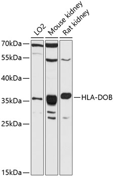 Western blot analysis of extracts of various cell lines using HLA-DOB Polyclonal Antibody at 1:3000 dilution.