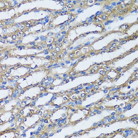 Immunohistochemistry of paraffin-embedded Mouse kidney using NQO2 Polyclonal Antibody at dilution of 1:100 (40x lens).