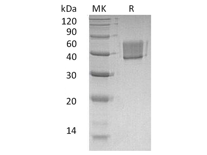 Recombinant Human FCRL1 Protein (His Tag)