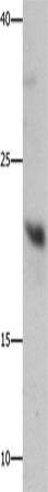 Western Blot analysis of Mouse liver tissue using GFER Polyclonal Antibody at dilution of 1:750