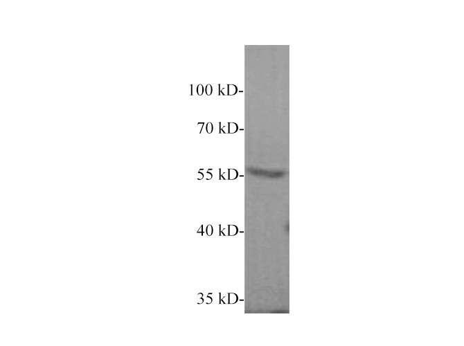 Western blot of Human plasma with anti-CPB2 polyclonal antibody at 1:1000 dilution.