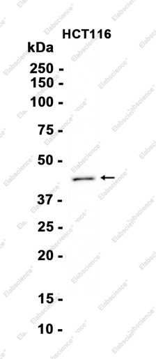 Recombinant IKB beta Monoclonal Antibody - 2