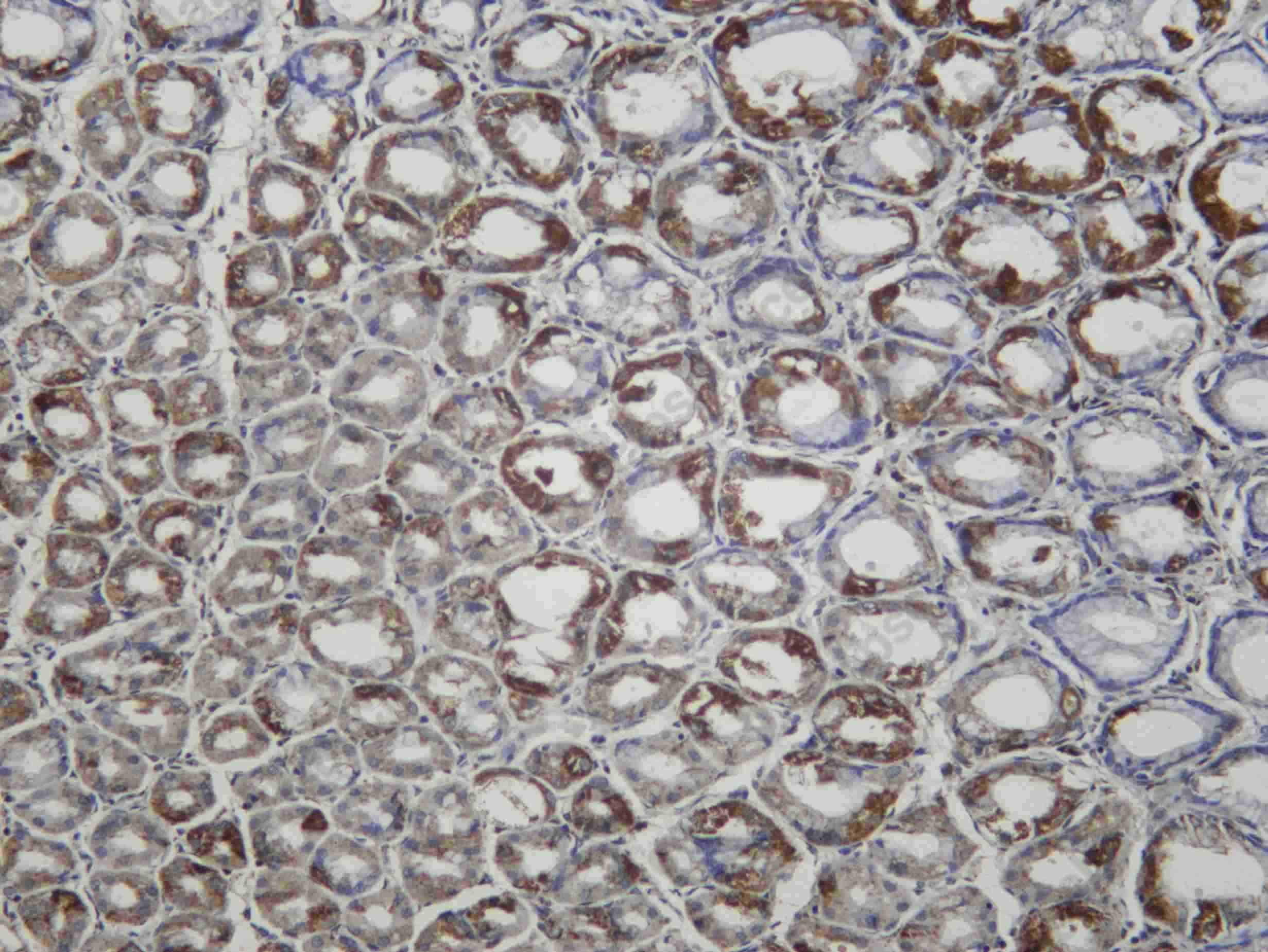 Recombinant SGK1 Monoclonal Antibody - 2