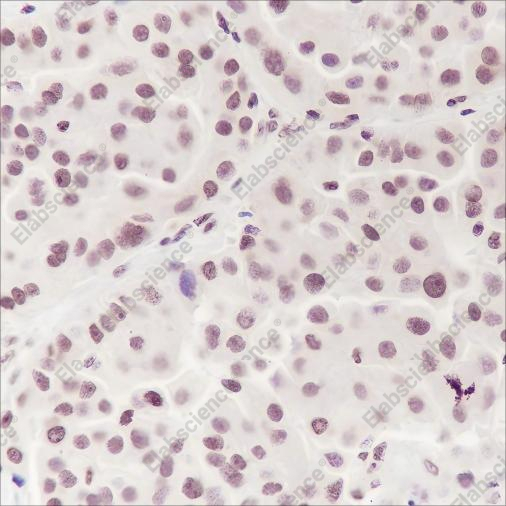 Recombinant Ataxin-3 Monoclonal Antibody - 1