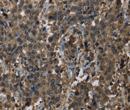 GSTA3 Polyclonal Antibody - 3