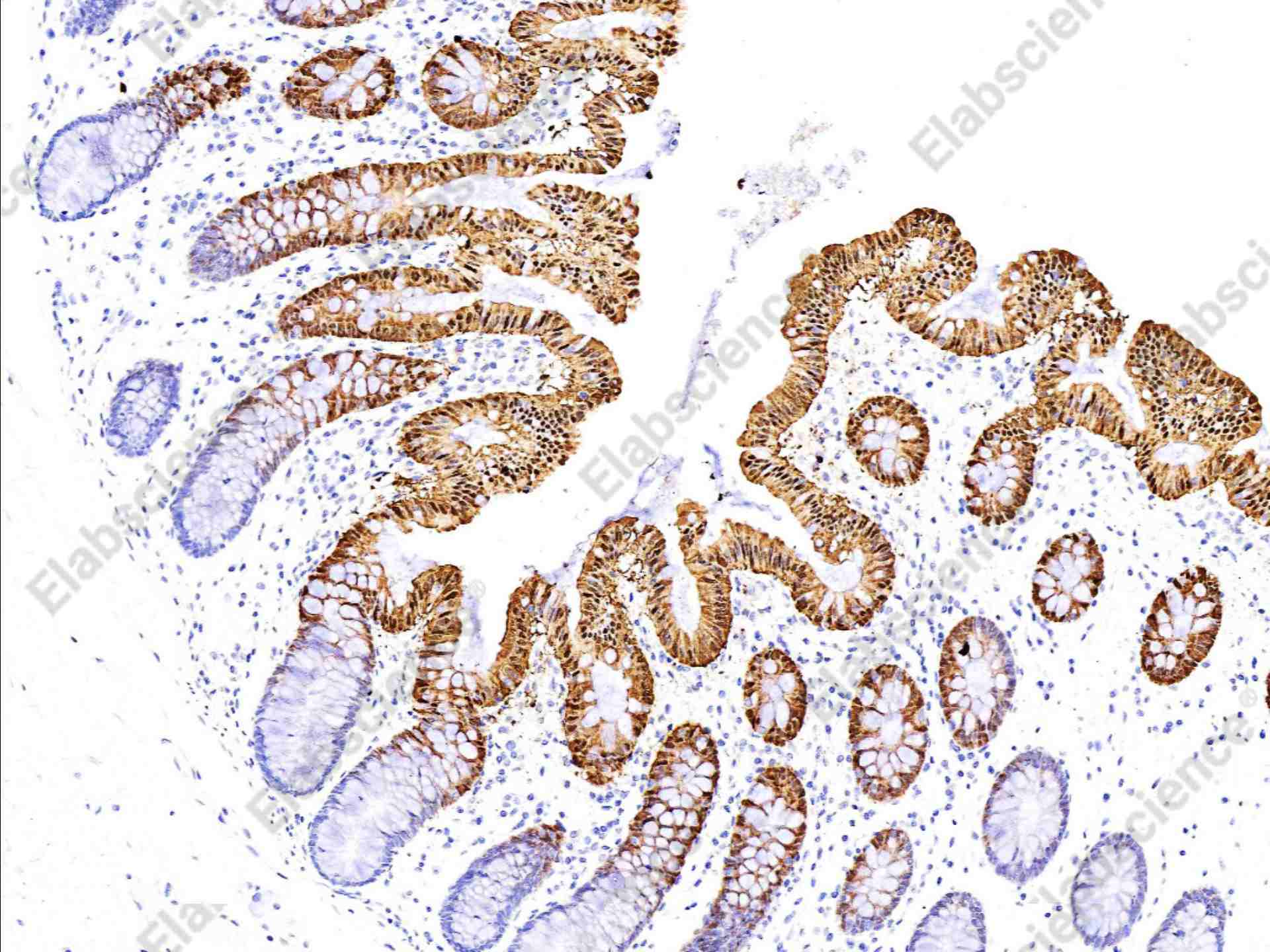 Recombinant Carbonic Anhydrase II/CA2 Monoclonal Antibody - 1