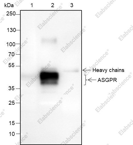 Recombinant ASGR1 Monoclonal Antibody - 2