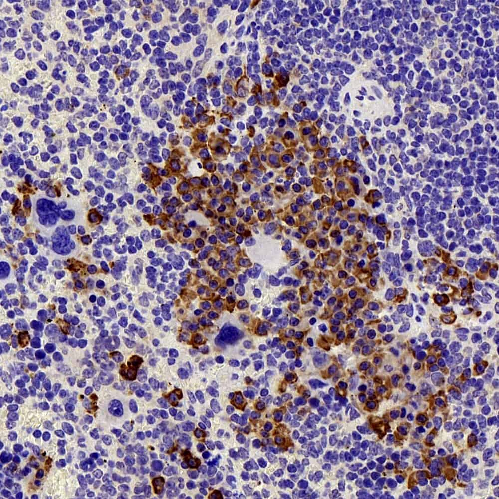 Immunohistochemistry analysis of paraffin-embedded mouse Immunized spleen  using FAS Polyclonal Antibody at dilution of 1:300.