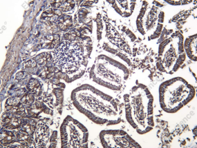 Recombinant ALDH1A2 Monoclonal Antibody - 2