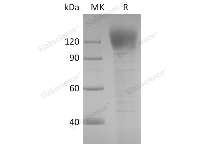 Immobilized 2019-nCoV S1 Protein-His at 2ug/ml (100 ul/well) can bind SARS-COV-2 Spike Monoclonal Antibody(2019-nCoV)(5D9)(Cat#E-AB-V1001). The ED50 of E-AB-V1001 is 36. 9 ng/ml.