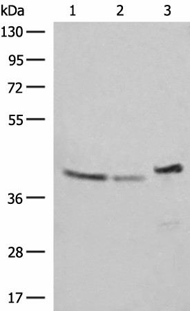 Western blot analysis of SKOV3 Hela and HepG2 cell lysates  using ERAL1 Polyclonal Antibody at dilution of 1:500