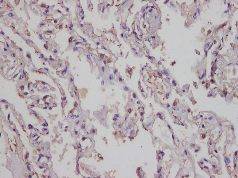 AF/LE Purified Anti-Human CD200 Antibody[OX-104]-产品推荐-1
