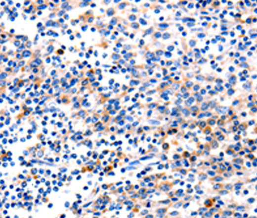 Immunohistochemistry of paraffin-embedded Human tonsil tissue using GADD45 gamma Polyclonal Antibody at dilution 1:120