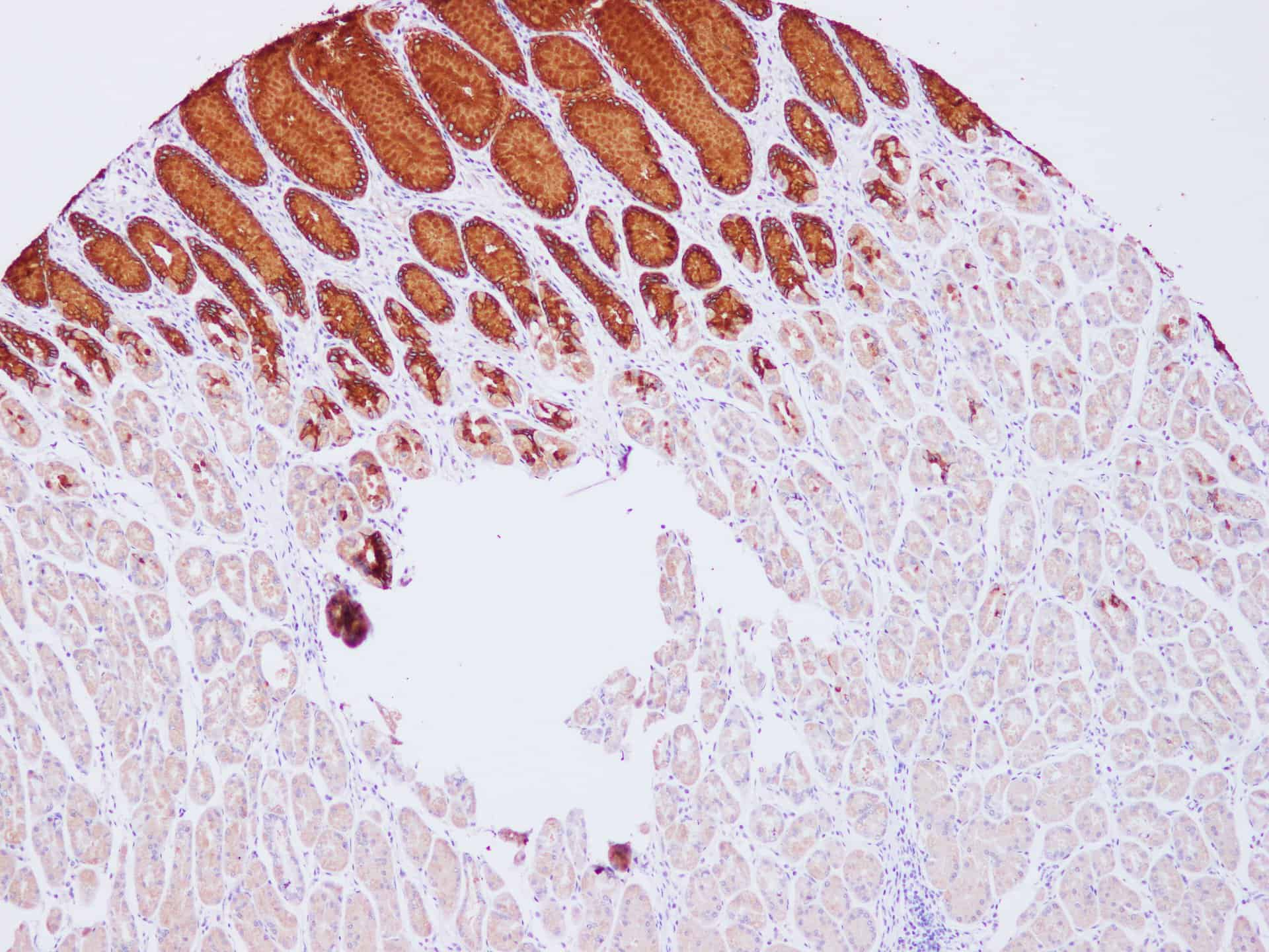 Immunohistochemistry of paraffin-embedded Human stomach using MUC5AC Polyclonal Antibody at dilution of 1:100(100?)