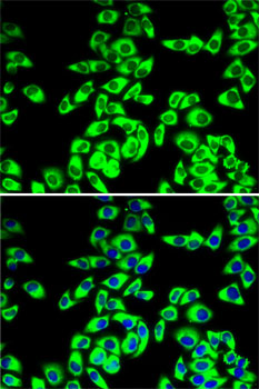 Immunofluorescence analysis of MCF7 cells using RPL14 Polyclonal Antibody Blue: DAPI for nuclear staining.