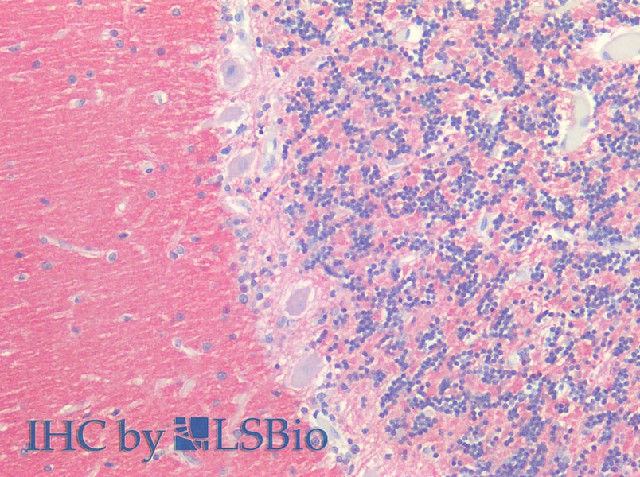 Immunohistochemistry of paraffin-embedded Human Brain using SNAP25 Polyclonal Antibody at dilution of 1:100(Elabscience Product Detected by Lifespan).