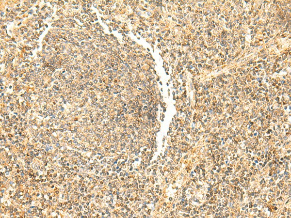 Immunohistochemistry of paraffin-embedded Human tonsil tissue  using DHFR Polyclonal Antibody at dilution of 1:50(?200)