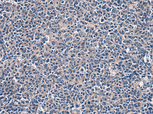 Immunohistochemistry of paraffin-embedded Human tonsil tissue  using LAMP3 Polyclonal Antibody at dilution of 1:30(?200)