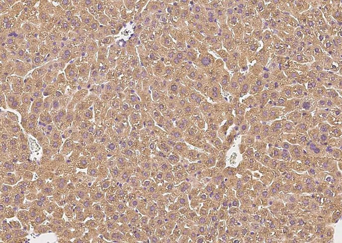 Recombinant Complement Factor H Monoclonal Antibody-searchlist-1