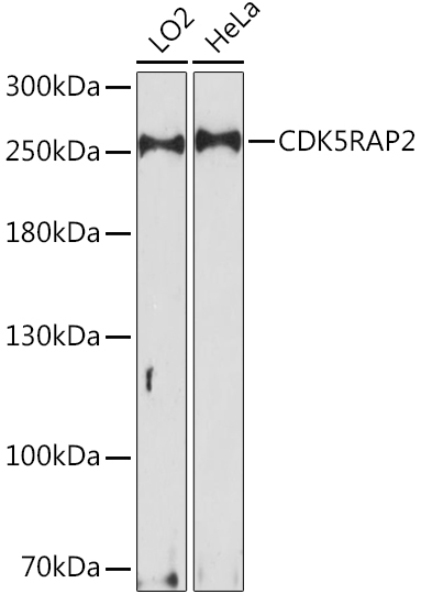 Western blot analysis of extracts of various cell lines using CDK5RAP2 Polyclonal Antibody at1:1000 dilution.